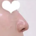 鼻尖形成（切開） / 鼻中隔延長（切開） / 小鼻縮小（切開） / 軟骨移植 / 骨切幅寄せ リラ・クラニオフェイシャル・クリニック DAY 306 サムネイル用