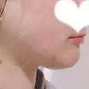 その他（輪郭） リラ・クラニオフェイシャル・クリニック DAY 306 サムネイル用