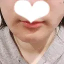 その他（輪郭） リラ・クラニオフェイシャル・クリニック DAY 306 サムネイル用