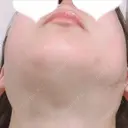 その他（輪郭） リラ・クラニオフェイシャル・クリニック DAY 306 サムネイル用