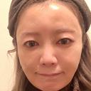 糸リフト / 脂肪吸引（顔） / 下まぶたたるみ取り / 眉下切開 / 脂肪注入（額） / 脂肪注入（輪郭） e:Top clinic（イートップクリニック） DAY 10 サムネイル用