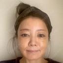 糸リフト / 脂肪吸引（顔） / 下まぶたたるみ取り / 眉下切開 / 脂肪注入（額） / 脂肪注入（輪郭） e:Top clinic（イートップクリニック） DAY 11 サムネイル用
