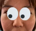 シミ取りレーザー / 光治療（フォトフェイシャルなど） 渋谷美容外科クリニック 新橋院 DAY 14 サムネイル用