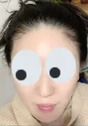再生医療 クリニックビューティー恵比寿 DAY 38 サムネイル用