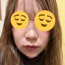 鼻尖形成（切開） / 小鼻縮小（切開） / その他（鼻） YBC横浜美容外科 大宮院 DAY 21 サムネイル用