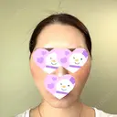 脂肪吸引（顔） / 切開リフト / PRP皮膚再生療法 湘南美容クリニック 新宿本院 DAY 49 サムネイル用
