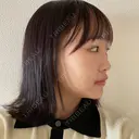 目頭切開 / タレ目形成・グラマラスライン（切開） / 口角挙上 / ボトックス（あご） / その他（口元） 東京形成美容外科 船橋院 DAY 6 サムネイル用