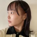 目頭切開 / タレ目形成・グラマラスライン（切開） / 口角挙上 / ボトックス（あご） / その他（口元） 東京形成美容外科 船橋院 DAY 6 サムネイル用