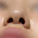 人中短縮 eクリニック 金沢本院 DAY 18 サムネイル用