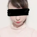 脂肪吸引（顔） / その他（輪郭） / 脂肪注入（輪郭） ヴィヴェンシアクリニック AFTER サムネイル用