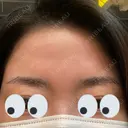 アートメイク（眉） AIM Beauty Medical Clinic DAY 1 サムネイル用
