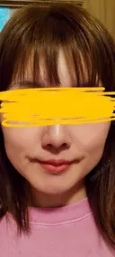 軟骨移植 LIKI CLINIC KOBE DAY 57 サムネイル用