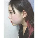 バッカルファット除去 / その他（輪郭） / ヒアルロン酸注入（あご） / ボトックス（エラ・小顔） エートップ美容整形外科 DAY 1 サムネイル用