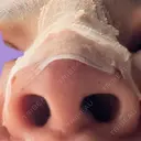 隆鼻術 / 鼻尖形成（切開） / 軟骨移植 白山クリニック 大分 DAY 2 サムネイル用