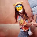 ヒアルロン酸注入（あご） / ボトックス（エラ・小顔） / 脂肪溶解注射（顔） 品川スキンクリニック神戸院（※品川美容外科提携） AFTER サムネイル用