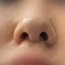 人中短縮 eクリニック 金沢本院 DAY 30 サムネイル用