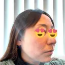 その他（肌） CHRISTINA CLINIC 銀座 DAY 8 サムネイル用