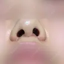 人中短縮 eクリニック 金沢本院 DAY 37 サムネイル用