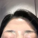 アートメイク（眉） AIM Beauty Medical Clinic DAY 18 サムネイル用