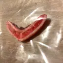 骨切り（あご） 銀座マイアミ美容外科 DAY 0 サムネイル用