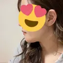 骨切り（あご） ヤスミクリニック DAY 58 サムネイル用