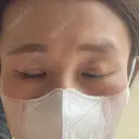 二重切開 / 眼瞼下垂（切開） 湘南美容クリニック Regno 銀座院 DAY 59 サムネイル用