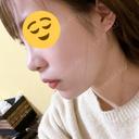 鼻尖形成（切開） / 小鼻縮小（切開） / その他（鼻） YBC横浜美容外科 大宮院 DAY 62 サムネイル用