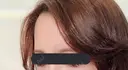 額を丸く / 脂肪注入（額） id（アイディ）美容外科 DAY 45 サムネイル用