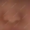 その他 TCB東京中央美容外科 新横浜院 AFTER サムネイル用