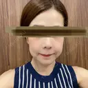 鼻尖縮小 リッツ美容外科 大阪院 DAY 211 サムネイル用