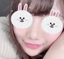 隆鼻術 / 鼻尖形成（切開） / 鼻中隔延長（切開） / 軟骨移植 グロービー美容整形外科 DAY 114 サムネイル用