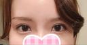 二重切開 / 上まぶたの脂肪取り id（アイディ）美容外科 AFTER サムネイル用