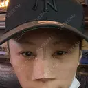 目頭切開 / 隆鼻術 / 鼻尖形成（切開） / 軟骨移植 湘南美容クリニック 金山院 DAY 0 サムネイル用