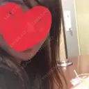 骨切り（あご） 自由が丘クリニック AFTER サムネイル用