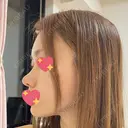 軟骨移植 R.O.clinic DAY 94 サムネイル用