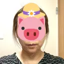 切開リフト 石倉クリニック 水戸院 AFTER サムネイル用