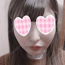 バッカルファット除去 / 脂肪吸引（顔） / ボトックス（あご） / ヒアルロン酸注入（あご） / ボトックス（エラ・小顔） / ヒアルロン酸注入（唇） / ボトックス（口角） エートップ美容整形外科 DAY 45 サムネイル用