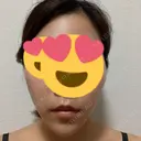 糸リフト / ヒアルロン酸注入（あご） 大阪消化器内科・内視鏡クリニック難波院 DAY 1 サムネイル用