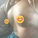 脂肪吸引（脚） / 豊胸（脂肪注入） 銀座マイアミ美容外科 DAY 1 サムネイル用