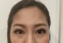 二重埋没 BIANCA表参道 DAY 15 サムネイル用