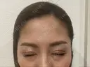 二重埋没 BIANCA表参道 DAY 15 サムネイル用