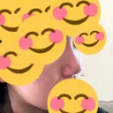 ヒアルロン酸注入（鼻） 東京美容外科 銀座院 DAY 10 サムネイル用