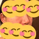 ヒアルロン酸注入（鼻） 東京美容外科 銀座院 AFTER サムネイル用