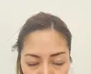 二重埋没 BIANCA表参道 DAY 16 サムネイル用