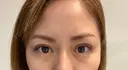 二重埋没 BIANCA表参道 DAY 17 サムネイル用
