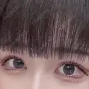 二重切開 / 目頭切開 / 上まぶたたるみ取り サラ美容外科 AFTER サムネイル用