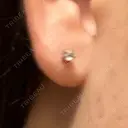 ピアス穴あけ 渋谷美容外科クリニック 渋谷院 DAY 3 サムネイル用