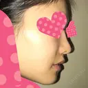 セットバック 大塚美容形成外科・歯科 大塚本院 AFTER サムネイル用