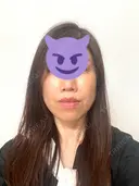 人中短縮 銀座アテナクリニック AFTER サムネイル用