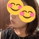 糸リフト / バッカルファット除去 / 脂肪吸引（顔） / ボトックス（エラ・小顔） アリエル美容クリニック 大宮院 DAY 5 サムネイル用